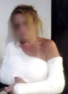 Život s nasilnikom: 'Rekao je: Vidjet ćeš kako ti lomim kost po kost. Tad je krenuo pravi pakao'